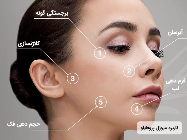 تزریق پروفایلو
