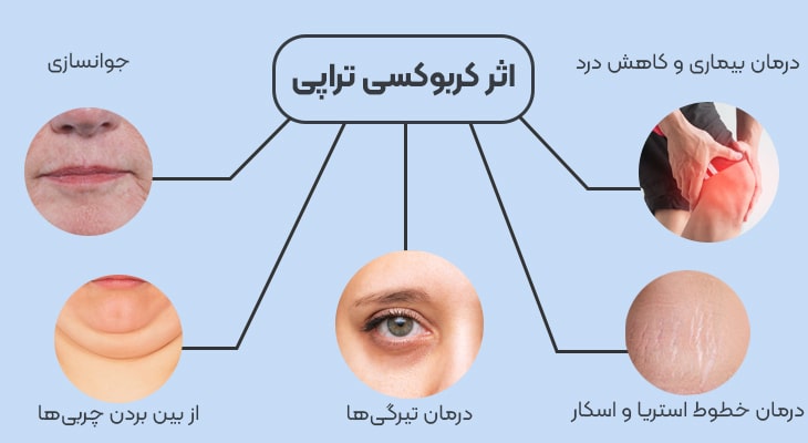 كربوكسي تراپي